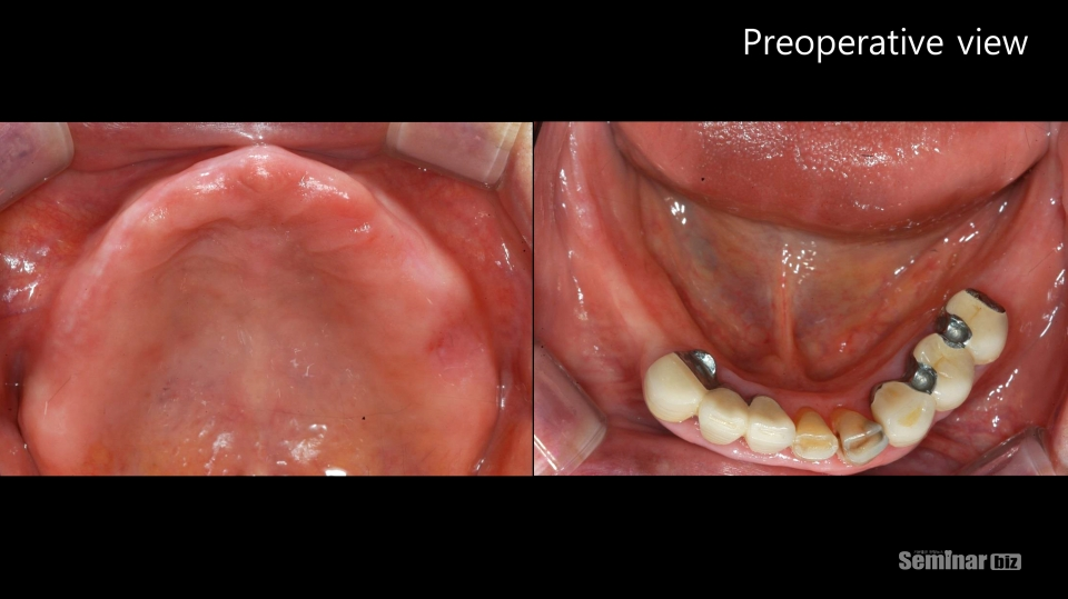 Preoperative view