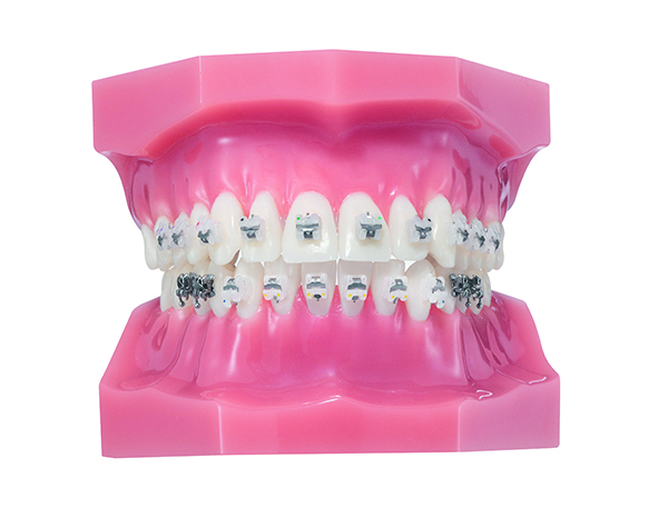 마제스티 브라켓부착사진