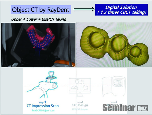 레이솔루션의 원리 