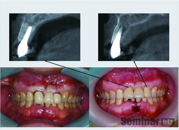 레이솔루션을 이용한 전인성 원장 케이스