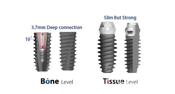 이번에 신규출시되는 덴티움의 브라이트임플란트는 임플란트의 미니멀리즘을 추구했다.
