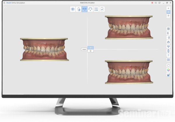 Medit Ortho Simulation