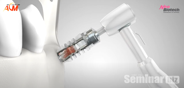 네오바이오텍의 ACM (Auto Chip Maker)