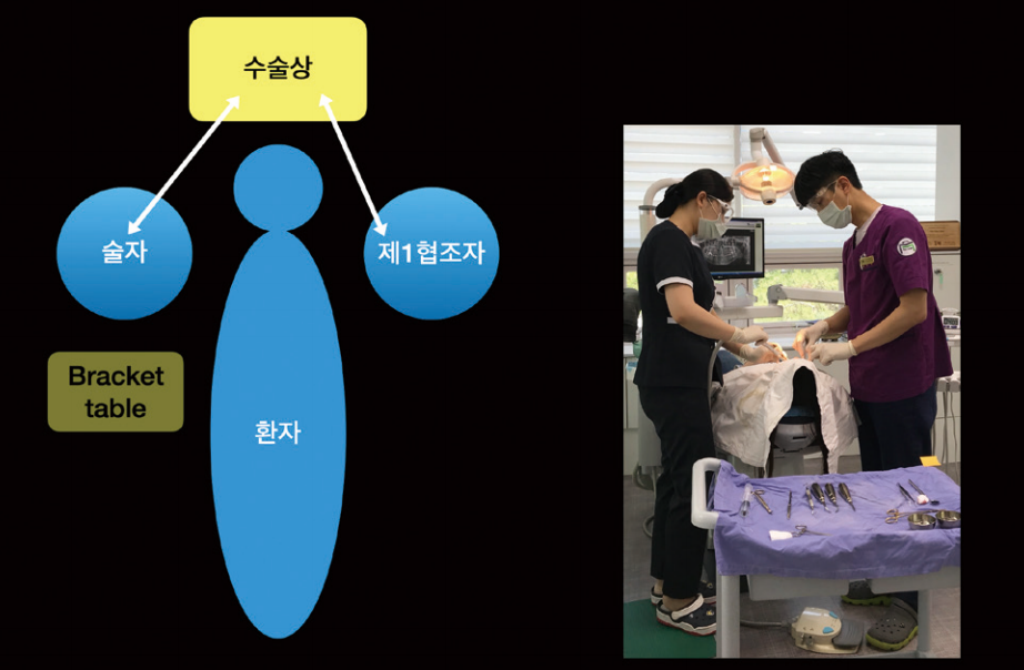 (그림 2) 간단한 소수술시, 별도의 기구 전달 협조자가 없음: 4-handed dentistry and rear delivery.