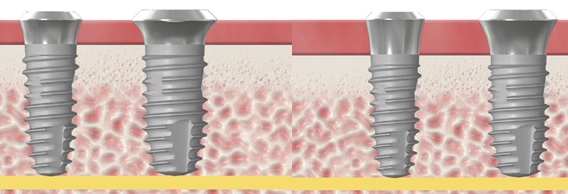 (좌)1.8G.Collar : Regular Neck / Wide Neck, (우)2.8G.Collar : Regular Neck / Wide Neck