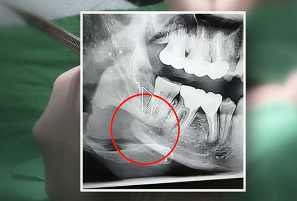 자료화면 : SBS 뉴스 보도 화면