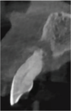 (그림 1) 중등도 이상의 치주질환