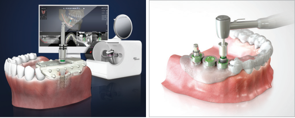 바로가이드(좌), 네비가이드(우)