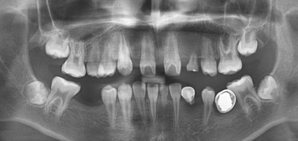 [그림 10] 초진파노라마