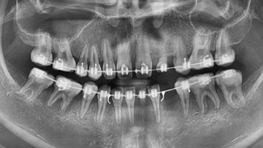 [그림 11] 술 전 파노라마