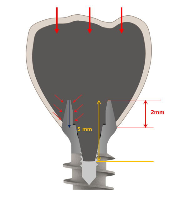 [그림 2] MagiCore의 double connection