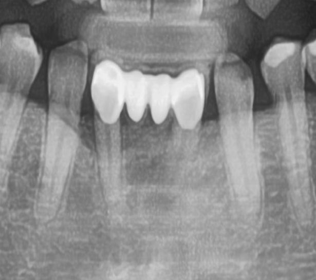 [그림 7] 초진 파노라마