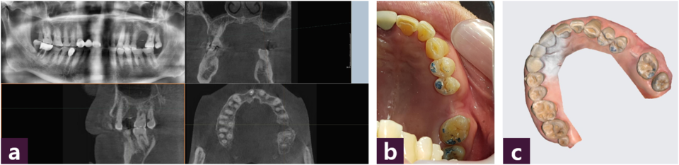 [그림 1] Input 자료  ⓐ CBCT, ⓑ intraoral photo, ⓒ intraoral scan image