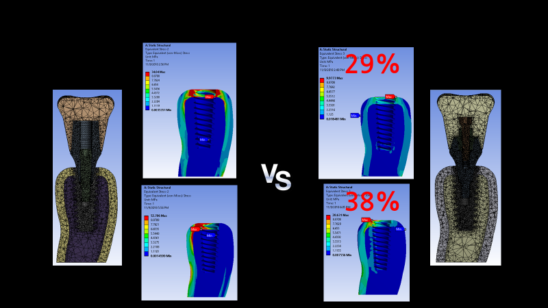 Fig. 9 Crestal marginal bone의 FEA