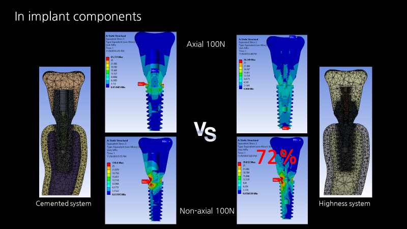 Fig. 3. 임플란트-보철 복합체의 FEA