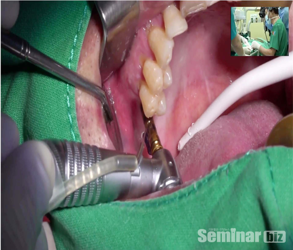 채널아미 라이브 쇼 실황 중계 화면