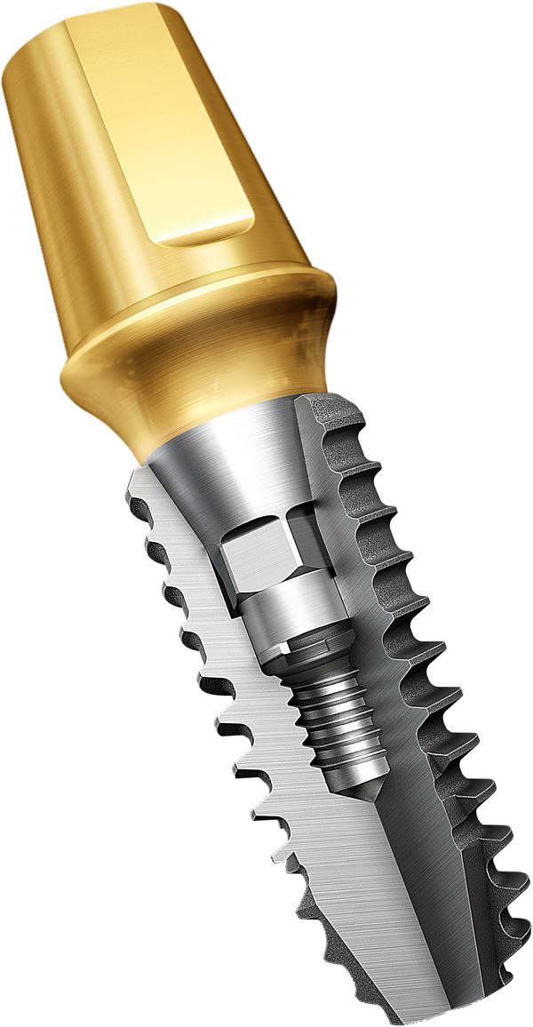 수술과 보철이 편리한 차세대 시스템 ‘KS System’