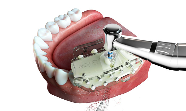 신기술 혁명의 결정체 VARO Guide