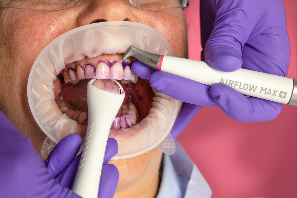 EMS에어플로우® MAX 핸드피스