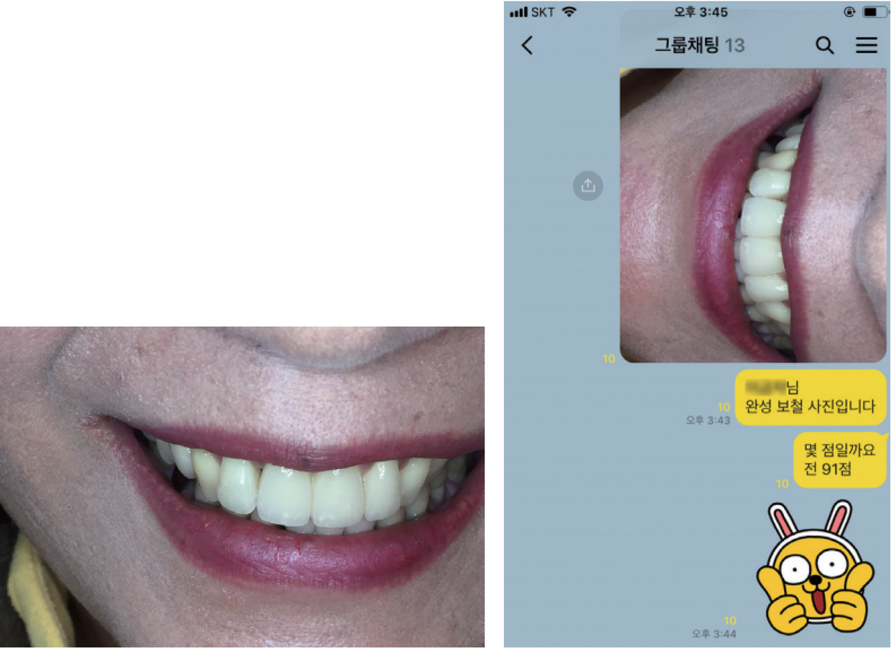 촬영 장비/Ceramist 아이폰 6Medi plus light ring flash 와이비기공소 임영빈 소장