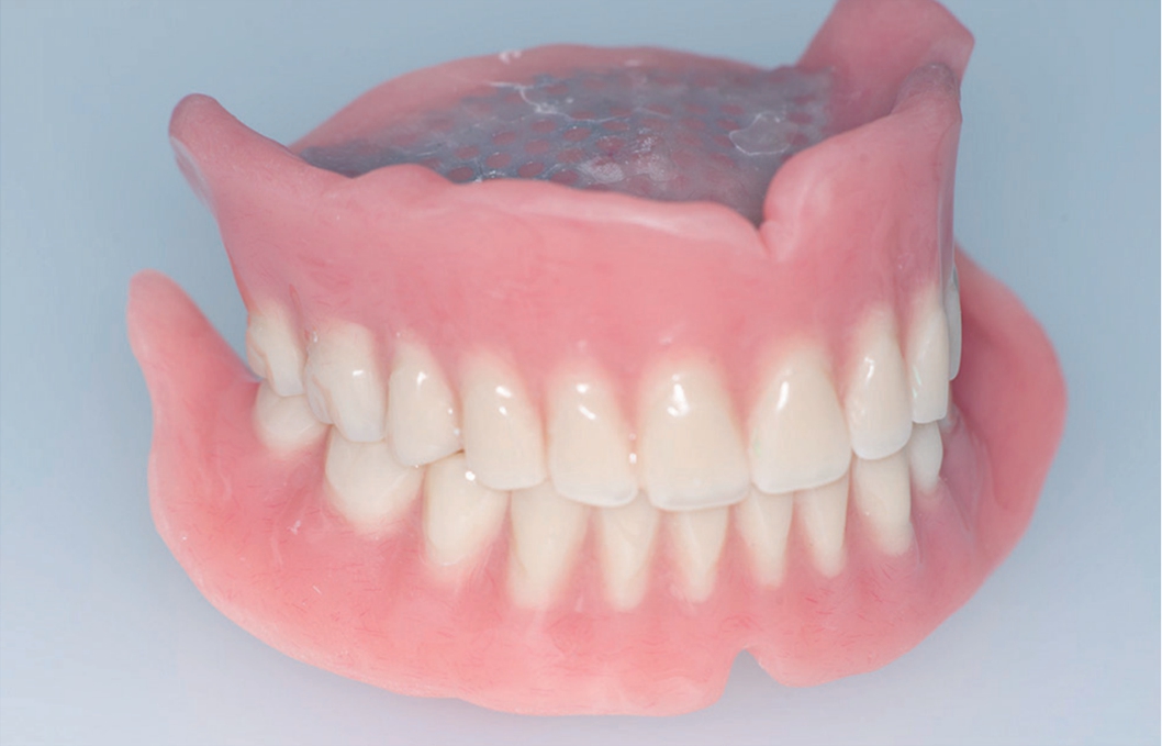 담당 치과기공사: 3D 치과기공소 정용성 소장