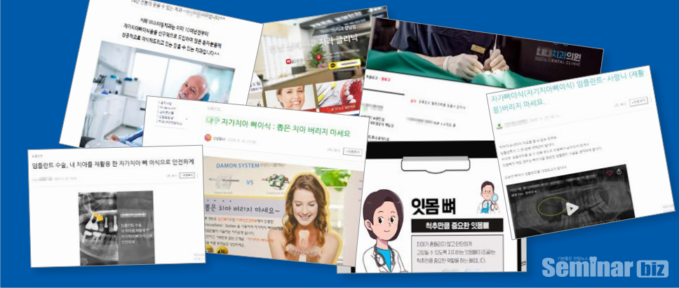 온라인에서 홍보하고 있는 무인증업체 제품을 이용한 자가치아뼈이식술 광고