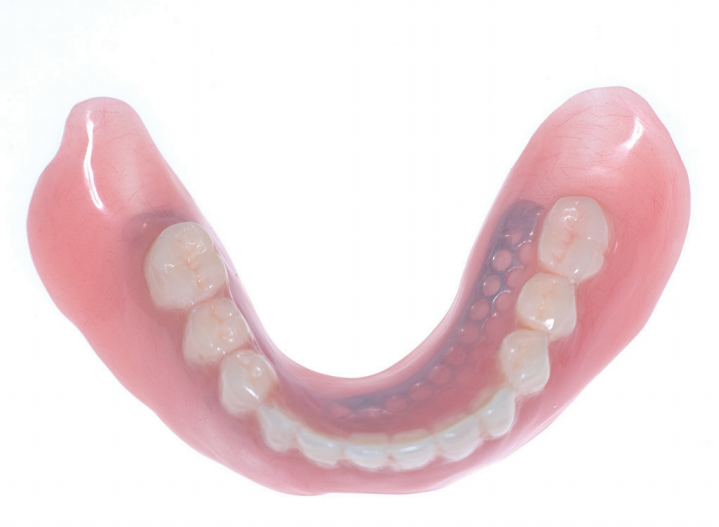 담당 치과기공사:이안비 치과기공소 김창환 실장