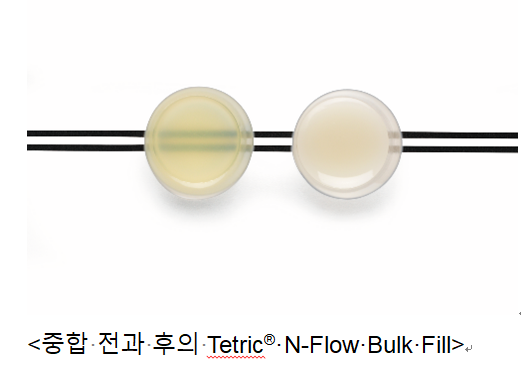 Aessencio®테크놀로지는 복합레진의 심미적 최적화를 보여준다. Tetric N-Flow Bulk Fill 샘플 아래의 검은색 선들은 광중합 전 명확하게 보이지만, 중합 후에는 반투명도의 변화로 선들이 가려지는 모습을 확인할 수 있다. 