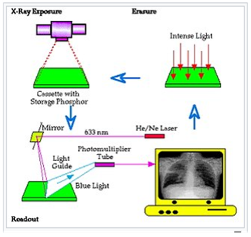 -방사선 노출량을 줄여주는 디지털 이미징 프로세스(CR)-