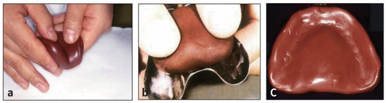 △ (그림 7) a) 손가락으로 주물러 균일한 색깔이 되도록 해준다，b) compound를 Tray에 올리는 모습，c) 치조능에 상응하는 groove가 형성된 모습.