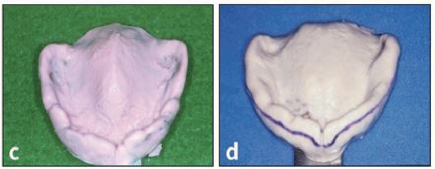 (그림 10) c, d) Alginate wash 인상.