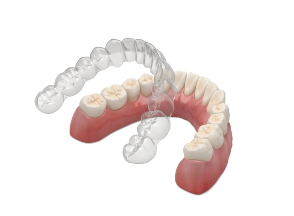 투명교정장치 매직얼라인(MagicAlign)