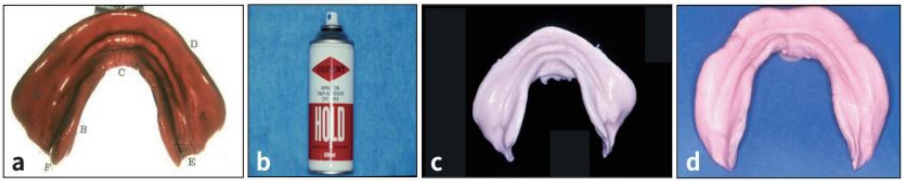 △ (그림 15) a) 수정이 끝난 compound 인상체, b) Alginate 접착제인 hold spray, c), d) Alginate wash에 의해 채득된 하악 1차 인상