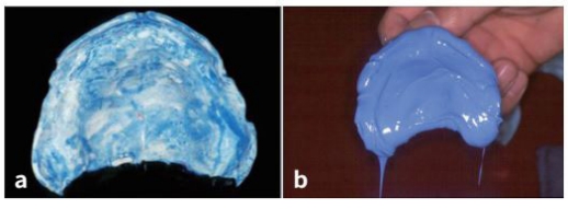 △ (그림 23) a) 트레이에 silicone 인상재의 점착제를 바른 모습, b) silicone 인상재를 트레이에 기포가 생기지 않도록 올려놓은 모습.