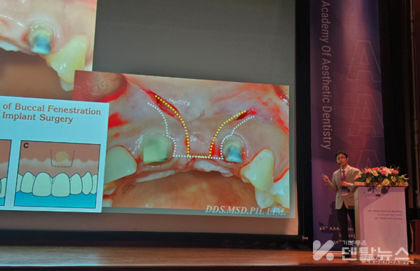 이번 AAAD 정기학술대회의 국제세션에서는 임필 인정의 학술이사가 한국 측 대표 연자로 강의했다.