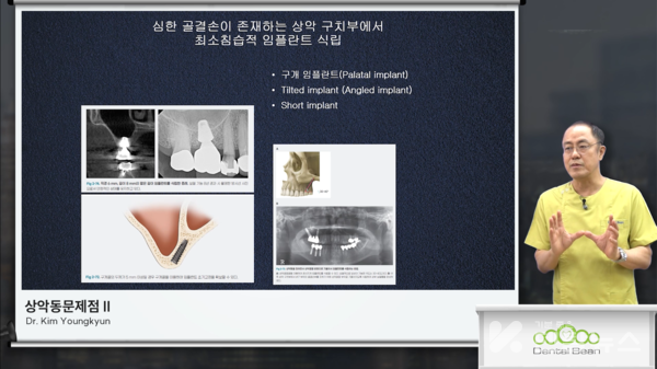 덴탈빈의 온라인 강의 김영균 교수의 턱관절강의 캡처