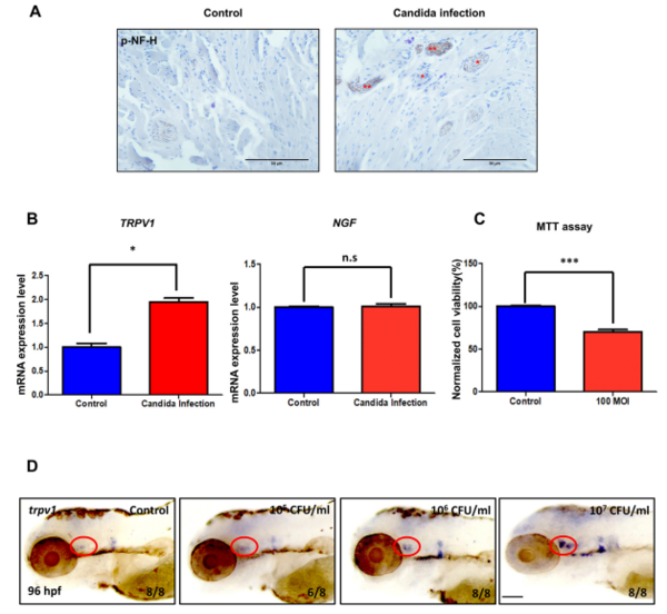공동저자 : 성현미(제1), 최은영, 주지영(부산대치과병원), 박혜련(부산대 치전원), 오창규(부산대 의대)(공동교신)