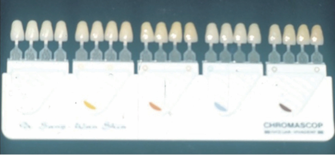 △  (그림 51) Ivoclar사의 Shade Guide(Chromascope).  1. Yellow(base), 2. Red(warmer), 3. Blue(cooler