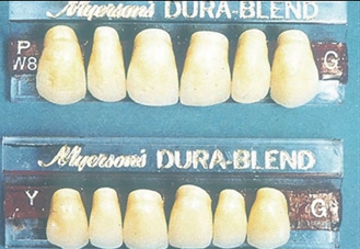 △ (그림 53) 인공치아 선택 시 환자의 얼굴모양, 치아 의 형태(mould)를 고려해야한다.