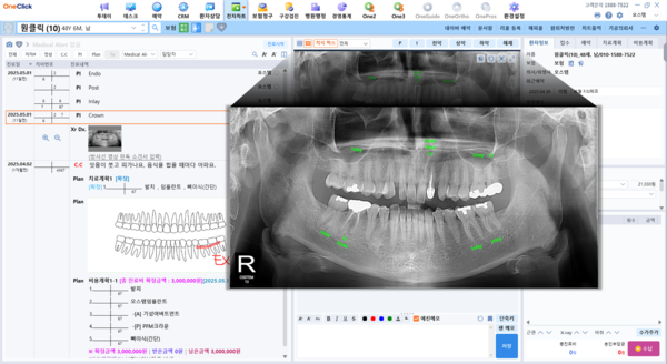 원클릭 파노라마 AI 진단 기능