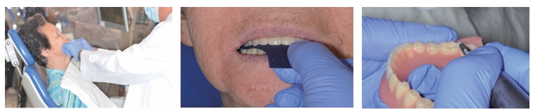 △ (그림 80) 심위 악간관계를 채득할 때 같은 자세에서 중심위관계를 check하고 교합지를 이용하여 premature contact 부위를 check한다.