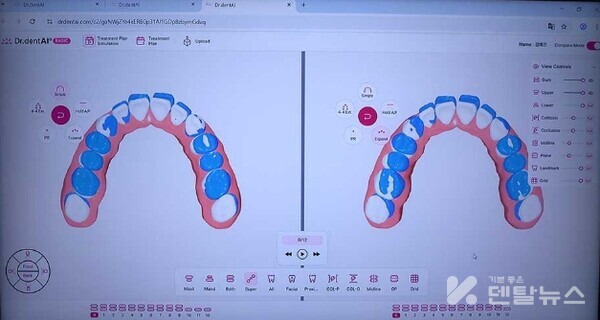 닥터덴트AI는 서로 다른 치료 옵션 시나리오를 동시에 보면서 비교할 수 있다 