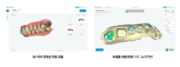 덴트버드는 3차원 형상데이터를  안정적이고 효과적으로 처리하는 독보적인 Generative  AI기술을 확보했다.