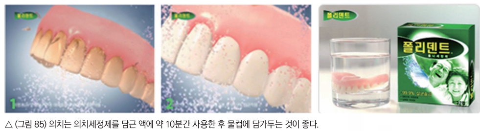 △  (그림 85) 의치는 의치세정제를 담근 액에 약 10분간 사용한 후 물컵에 담가두는 것이 좋다.