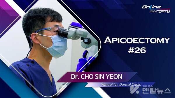 덴올 온라인서저리는 지난 5월부터 근관치료 케이스까지 범위를 넓혀 소개한다.