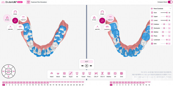 인공지능(AI) 기반 디지털 덴티스트리 스타트업 이노디테크(InnoDtech, 대표 주보훈)가 AI 교정 진단 솔루션 ‘닥터덴트AI(Dr.dentAI)’의 시뮬레이션 서비스를 출시했다