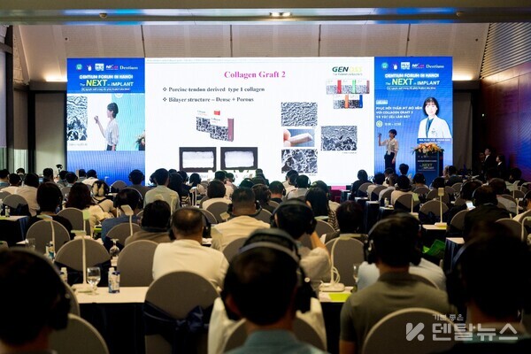 정성민 원장은 ‘Digital Minimalism’ 개념을 바탕으로 임플란트 치료의 단순화와 효율화에 대해 발표하며, 복잡한 술식을 최소화하면서도 정확성과 안정성을 확보할 수 있는 새로운 접근을 제시하였다. 덴탈뉴스