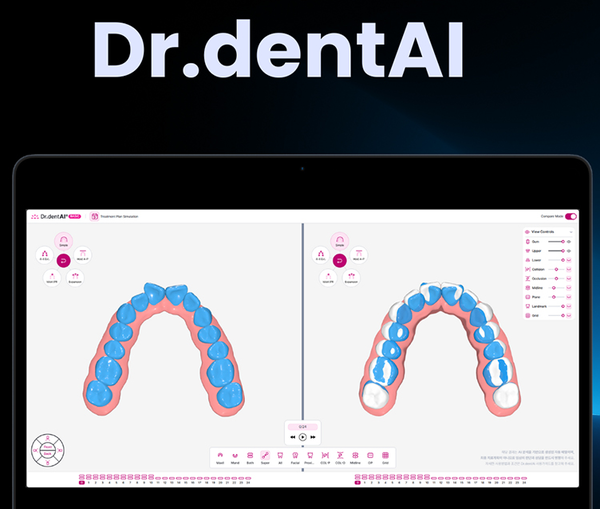 현재 이노디테크는 △AI 교정 진단 솔루션 ‘닥터덴트AI(Dr.dentAI)’ △환자 맞춤형 투명 교정 솔루션 ‘클라라AI(clara AI)’ △환자 대상 투명 교정 치료 관리 앱 ‘클라라(clara)’를 제공한다. 덴탈뉴스
