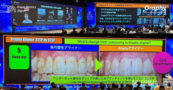 JAAO학회에서는 일본의 치과의사와 기공사가 한자리에 모여 그래피얼라이너의 임상적 효과를 발표하는 첫무대가 되었다. 덴탈뉴스