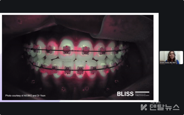 웨비나 세미나 진행중 -덴탈뉴스-